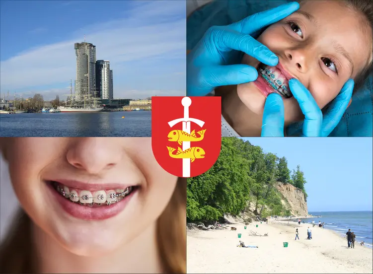 Gdynia - cennik ortodontów