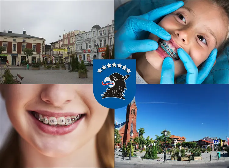Kartuzy - cennik ortodontów - sprawdź lokalne ceny aparatów na zęby