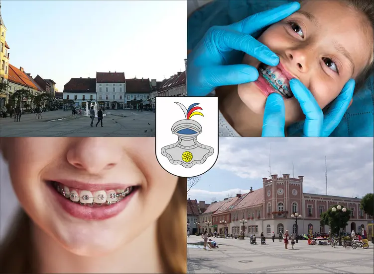 Mikołów - cennik ortodontów - sprawdź lokalne ceny aparatów na zęby