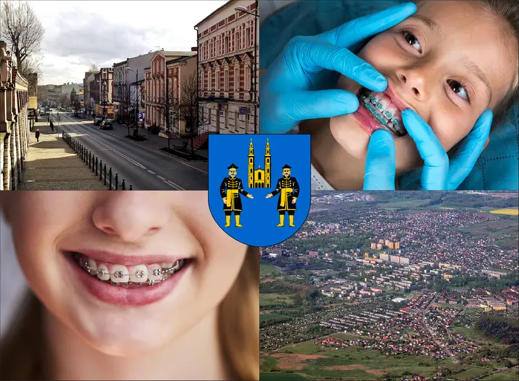 Piekary Śląskie - cennik ortodontów - sprawdź lokalne ceny aparatów na zęby