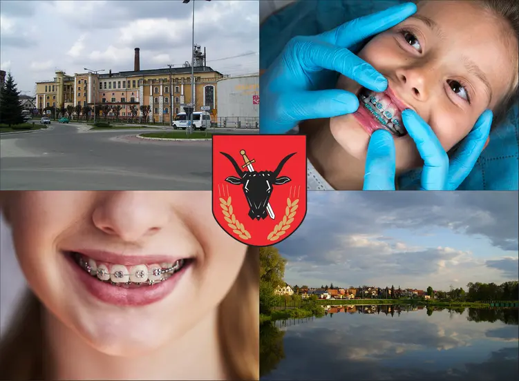 Kazimierza Wielka - cennik ortodontów - sprawdź lokalne ceny aparatów na zęby