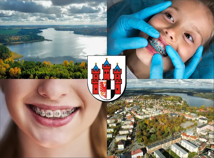 Olecko - cennik ortodontów - sprawdź lokalne ceny aparatów na zęby