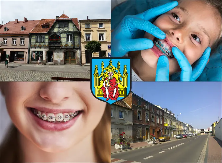 Grodzisk Wielkopolski - cennik ortodontów - sprawdź lokalne ceny aparatów na zęby