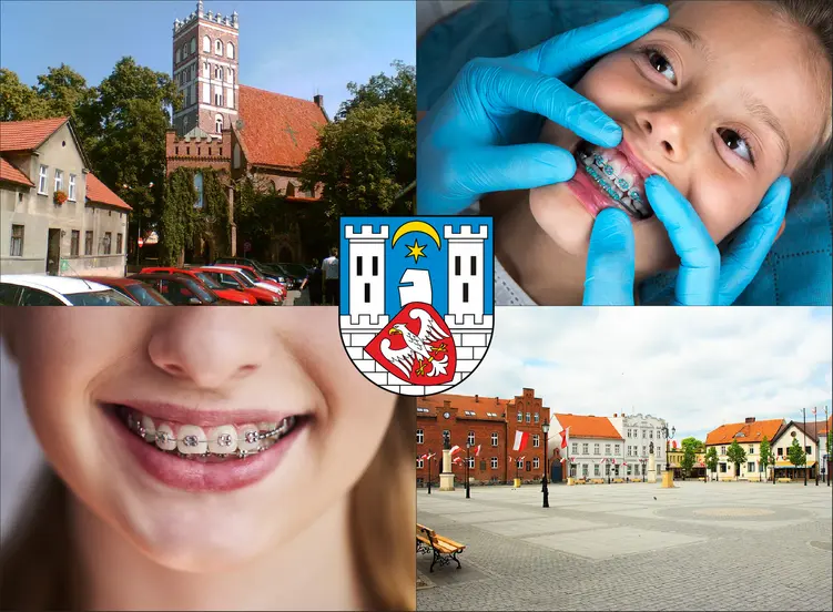 Środa Wielkopolska - cennik ortodontów - sprawdź lokalne ceny aparatów na zęby
