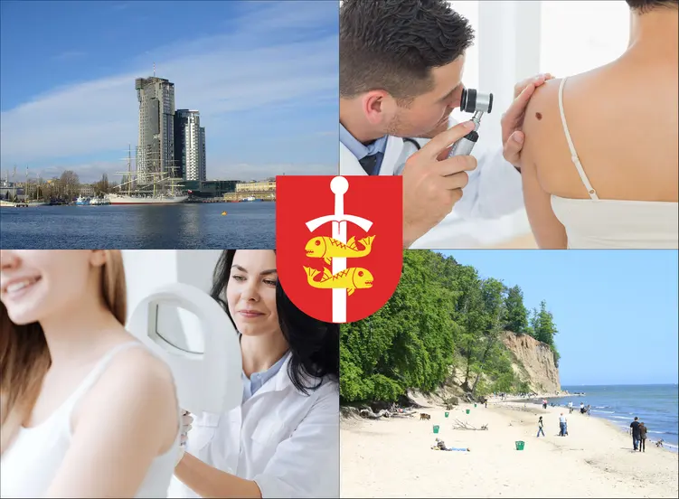 Gdynia - cennik dermatologów - zobacz lokalne ceny prywatnych wizyt