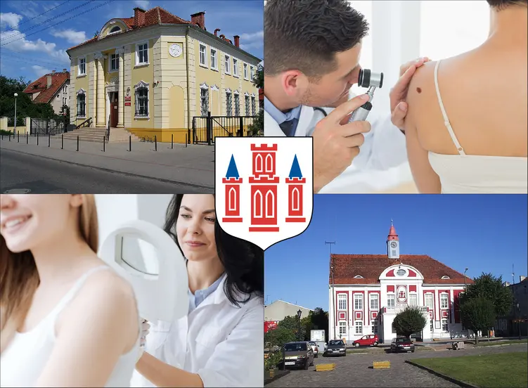 Gostyń - cennik dermatologów - zobacz lokalne ceny prywatnych wizyt