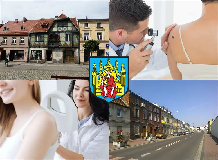 Grodzisk Wielkopolski - cennik dermatologów - zobacz lokalne ceny prywatnych wizyt