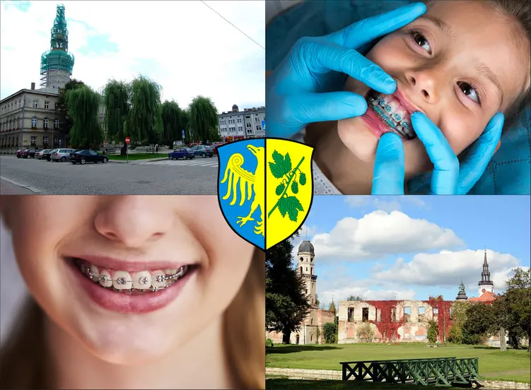 Strzelce Opolskie - cennik ortodontów - sprawdź lokalne ceny aparatów na zęby