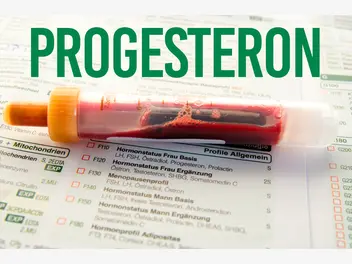 Fotografia ilustrująca cena badania progesteronu w ponad 160 miastach w całej polsce