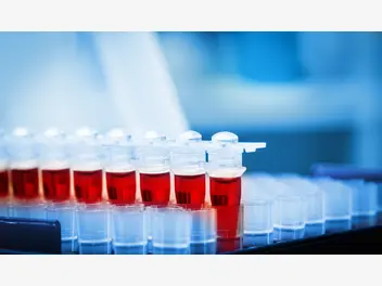 Fotografia ilustrująca cena badań na przeciwciała anty hiv w całej polsce