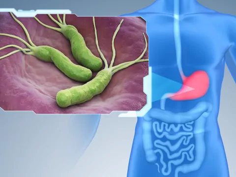 Ilustracja dla helicobacter pylori