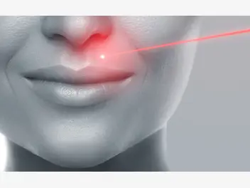 Fotografia ilustrująca cena zabiegów laserowych na twarz w ponad 160 miastach w polsce