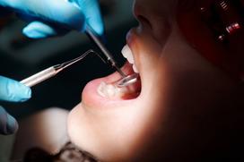 Czy warto stosować leczenie ortodontyczne u dorosłych?