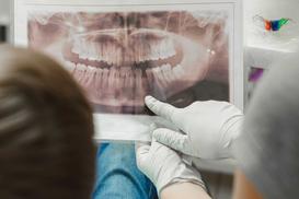 Cennik leczenia paradontozy - sprawdź aktualne ceny u dentystów