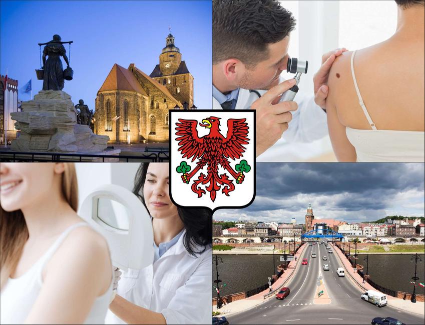 Gorzów Wielkopolski - cennik dermatologów - zobacz lokalne ceny prywatnych wizyt