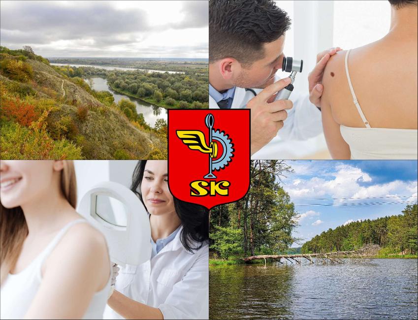 Skarżysko-Kamienna - cennik dermatologów - zobacz lokalne ceny prywatnych wizyt