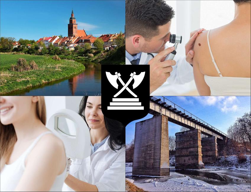 Bartoszyce - cennik dermatologów - zobacz lokalne ceny prywatnych wizyt