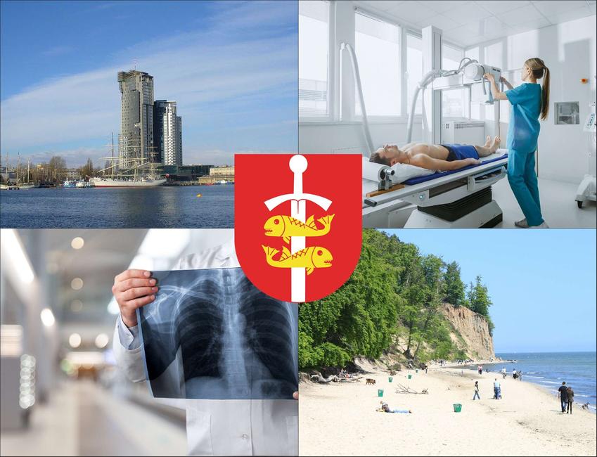 Gdynia - cennik rtg - sprawdź lokalne ceny badań rentgenowskich