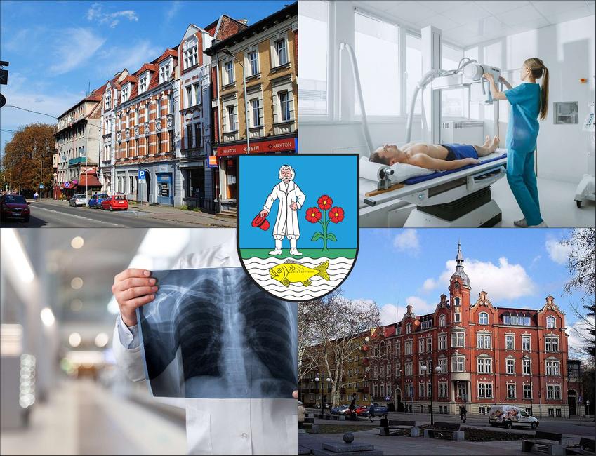 Siemanowice Śląskie - cennik rtg - sprawdź lokalne ceny badań rentgenowskich