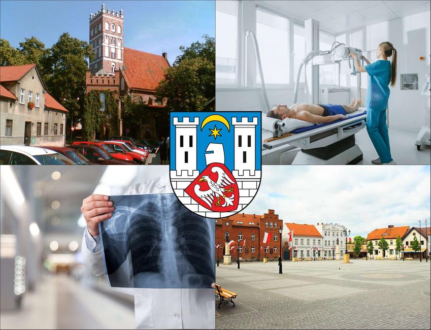 Środa Wielkopolska - cennik rtg - sprawdź lokalne ceny badań rentgenowskich