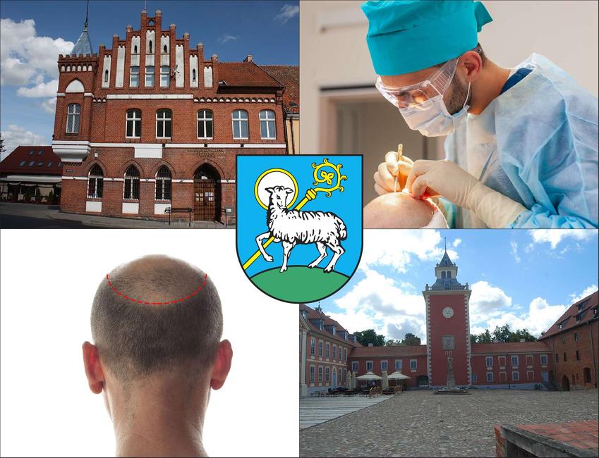 Lidzbark Warmiński - cennik przeszczepu włosów - zobacz lokalne ceny transplantacji włosów