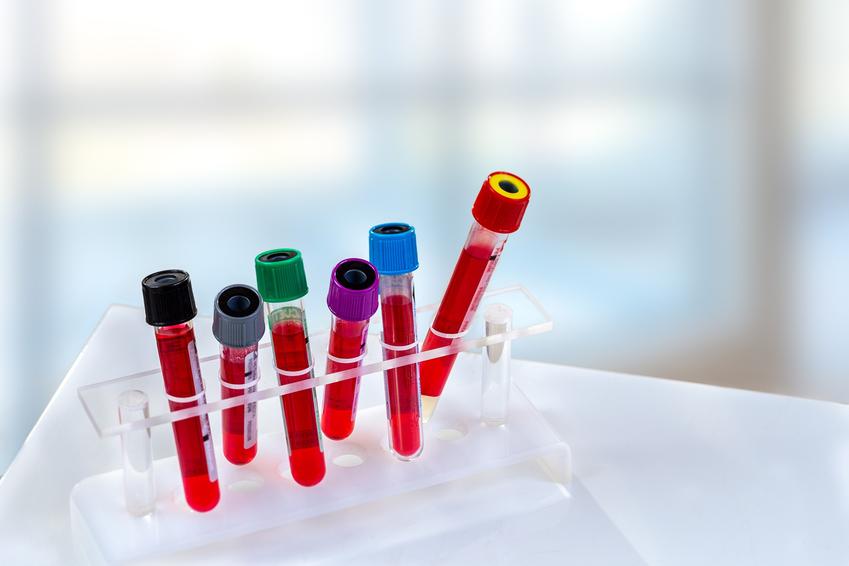 Bieruń - cennik badań laboratoryjnych - sprawdź ceny badania krwi i innych badań