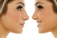 cennik operacji nosa - zobacz lokalne ceny operacji przegrody nosowej