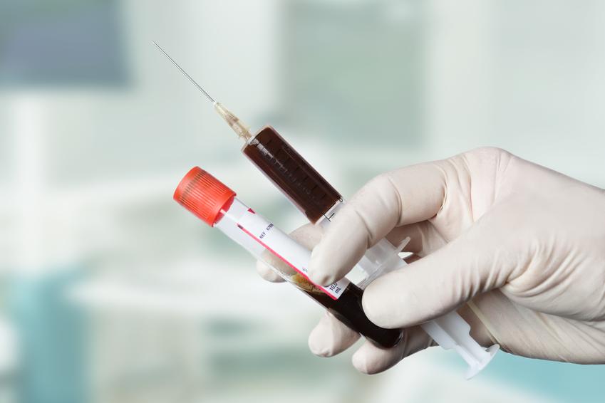 Uśredniony koszt wykonania badania poziomu żelaza we krwi. Świadczenia medyczne zwolnione z podatku VAT.